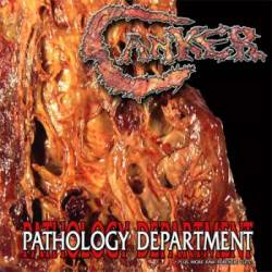 Canker (CAN) : Pathology Department